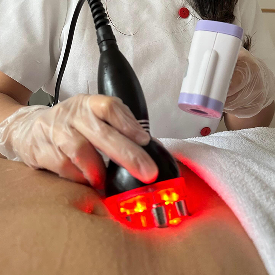 Tratamento RadioFrequência Corporal
